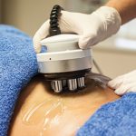 Body RF technology for skin tightening and cellulite removal