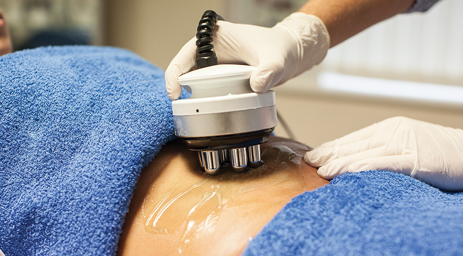 3d Rf Innovation For Skin Tightening And Cellulite Removal