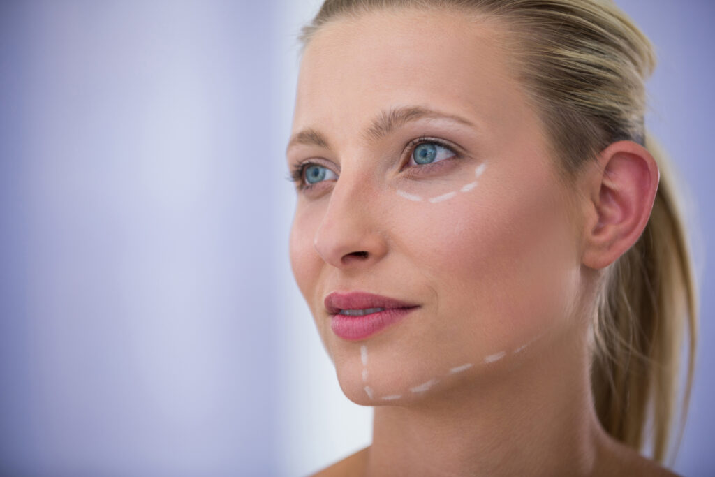 Close-up of woman with marks drawn for cosmetic treatment